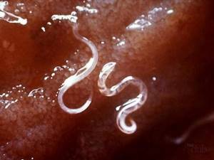 Рецепты содовых клизм против паразитов в человеческом организме