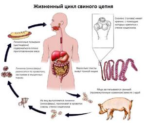 Где и при каких условиях человек может заразиться личинкой свиного цепня?