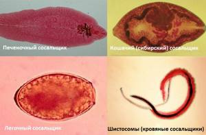 В каких органах человеческого тела могут обитать глисты и паразиты?
