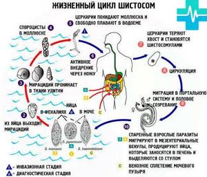 Шистосомы в организме человека. Виды, признаки и лечение