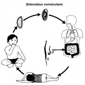 Энтеробиоз у взрослых и детей. Лечение препаратами и народной медициной