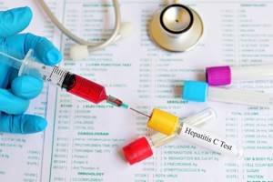 Сомнительный анализ на Гепатит С - советы врачей на каждый день