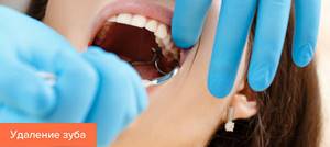 Гной после удаления зуба - советы врачей на каждый день