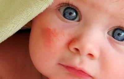 Повышены эозинофилы и базофилы у ребёнка в 1 год 8 месяцев - советы врачей на каждый день