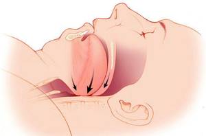 Проблемы с дыханием вт сне - советы врачей на каждый день