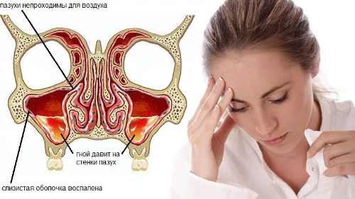 Частые головные боли и головокружения - советы врачей на каждый день