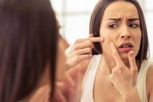 Прыщи на щеке - советы врачей на каждый день