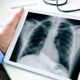 Помоги разобраться с результатами рентгена - советы врачей на каждый день