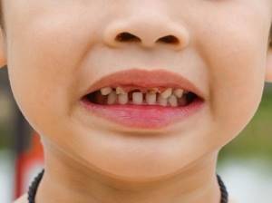 Ребенку год, крошатся зубы - советы врачей на каждый день
