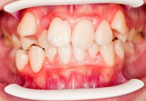 Возраст по зубам - советы врачей на каждый день