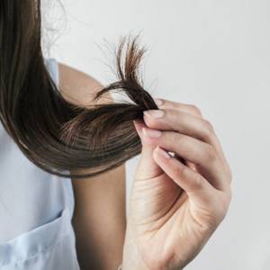 Выпадение волос в течении 2.5 лет - советы врачей на каждый день