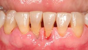 Боль в зубе - советы врачей на каждый день