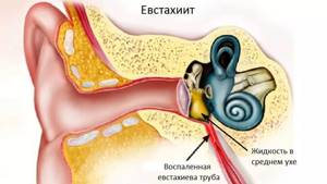 Нервные боли в ушах - советы врачей на каждый день