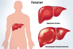 Гепатит В - сосотояние 3-мй год НЕВЫНОСИМОЕ при лечении ТЕНОФОВИРОМ - советы врачей на каждый день
