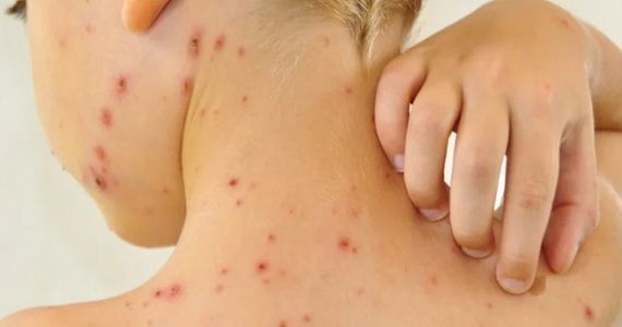 Что делать если не проходит воспаление на коже - советы врачей на каждый день