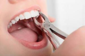 Гной после удаления зуба - советы врачей на каждый день