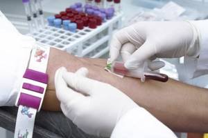 Плохой биохимический анализ крови - советы врачей на каждый день