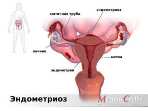 Увеличение менструального цикла - советы врачей на каждый день