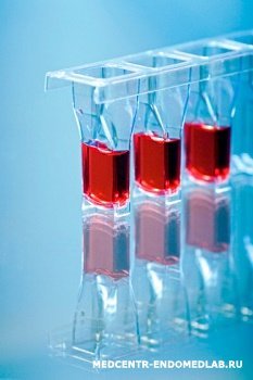 Обоснованность назначения исследования: тромбоцитарный гемостаз - советы врачей на каждый день