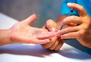 Онемение правой руки - советы врачей на каждый день