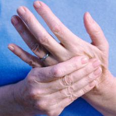 Зуд и шелушение кожи на кистях рук - советы врачей на каждый день