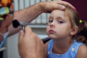 Хронический Аденоидит у ребенка - советы врачей на каждый день