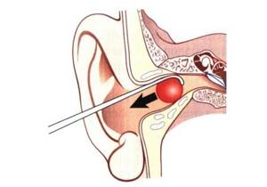 Почему болят уши - советы врачей на каждый день